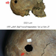 Evidence of trepanation—an early form of brain surgery—was discovered one one of the two male specimens.
